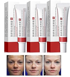 XSZD 3PC Effective Whitening Freckle Cream, 20g Acne Freckle Removal Cream for Face, Dark Spots Melasma Melanin Remover Cream Skin Whitening Cream (Freckle Whitening)