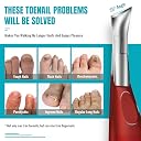 Toe Nail Clippers for Thick Nails - RONAVO Nail Clippers.Heavy Duty Professional Thick & Ingrown Toenail Clippers,Wide Jaw & Easy-Grip Long Handle,Ideal for Elderly/Diabetics/Men (Red) gallery image