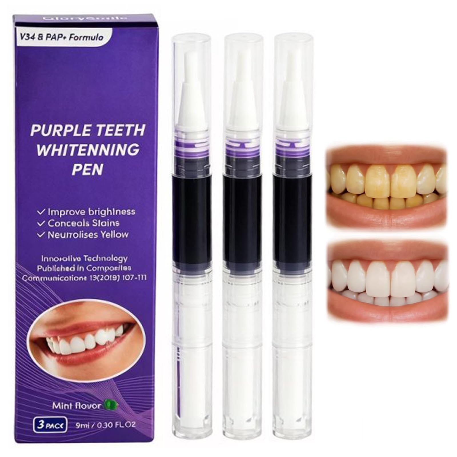 Penna Sbiancante Denti 3 Pezzi, Penna Sbiancante Viola per Denti Bianchi, Gel Sbiancante Denti contro Macchie di Caffè e Tè, Trattamento Sbiancamento Denti