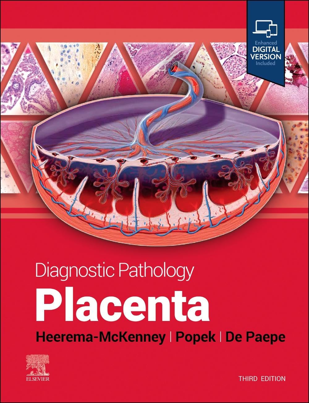 Diagnostic Pathology: Placenta, 3rd Edition | Expert Placental Pathology Guide for Pathologists & Residents