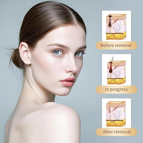 Miniatura 2 de GJW Skin Clinic Freeze Point para verrugas y anomalías de la piel - Uso amigable - Funciona para quitar anomalías de la piel