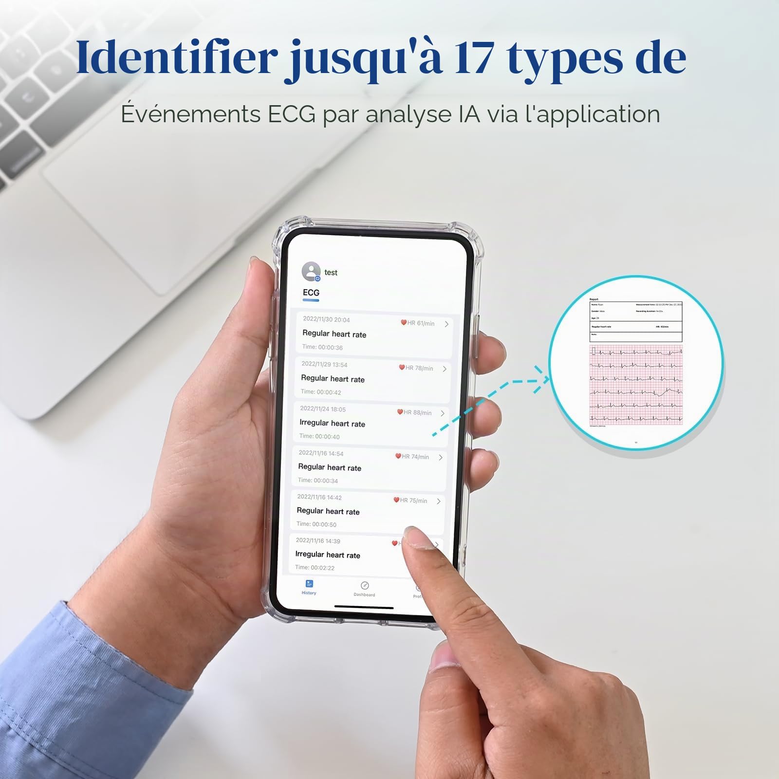 CheckMe ER2-S ECG pour la maison Appareil ECG portable avec ceinture thoracique précise (30 sec. à 15 min. d’enregistrement), visualisation en temps réel via l’application, espace de stockage illimité