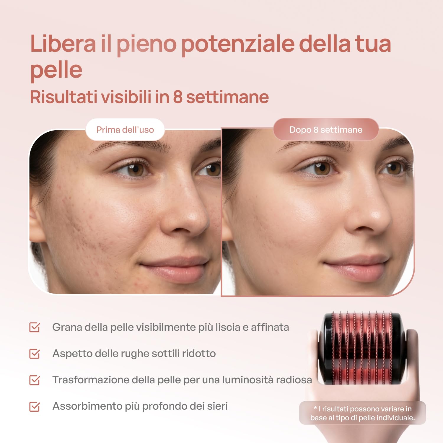 PLANTIFIQUE Dermaroller 0,25 mm – Microneedling Viso, Barba e Capelli, Rullo con Aghi in Titanio (540) – Derma Roller per Cuoio Capelluto e Viso – con Custodia