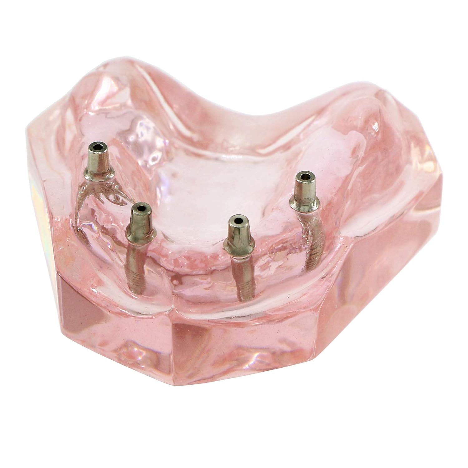 Dental Implant Teeth Demo Model Maxillary Overdenture with 4 Implants | removable overdenture，realistic details. Durable, precise dimensions, compact, for training.