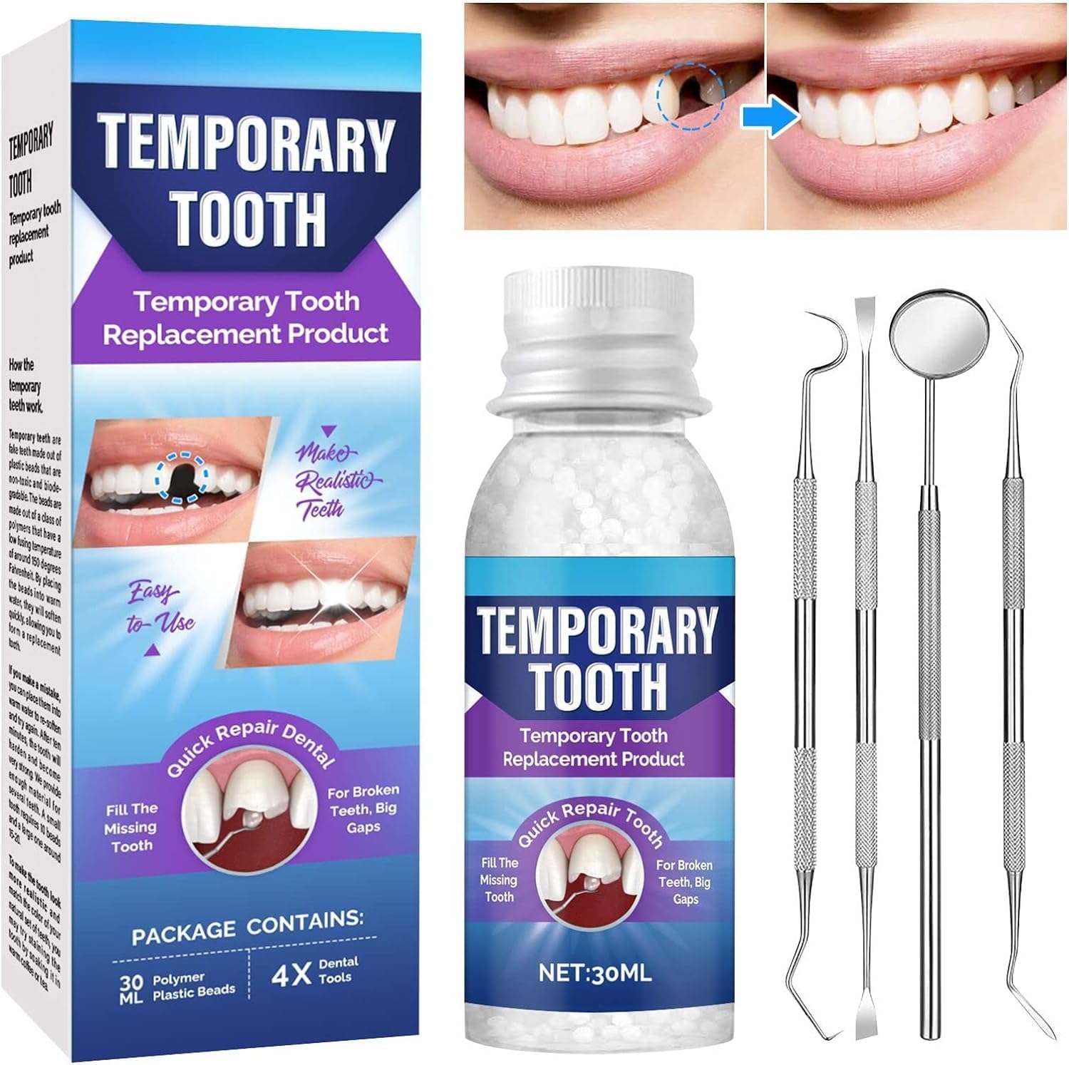 NALACAL DIY Tooth Filling Repair Kit for Missing and Broken Teeth – Easy Home Solution to Regain Your Confident Smile