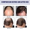 Hair Regrowth Foam for Men,Treatment for Men Growth Serum,Hair Regrowth Spray Foam Growth,60g