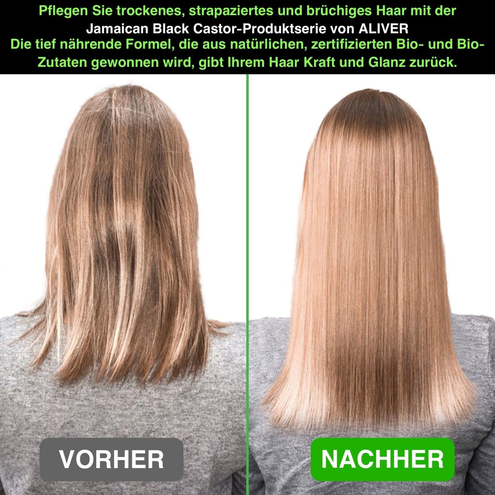 P-Beauty zestaw 4 oleju rycynowego, szamponu, odżywki i maski do włosów z biotyną, pielęgnacja włosów, pielęgnacja skóry głowy – szampon, odżywka, olejek do włosów, kuracja do włosów, szampon