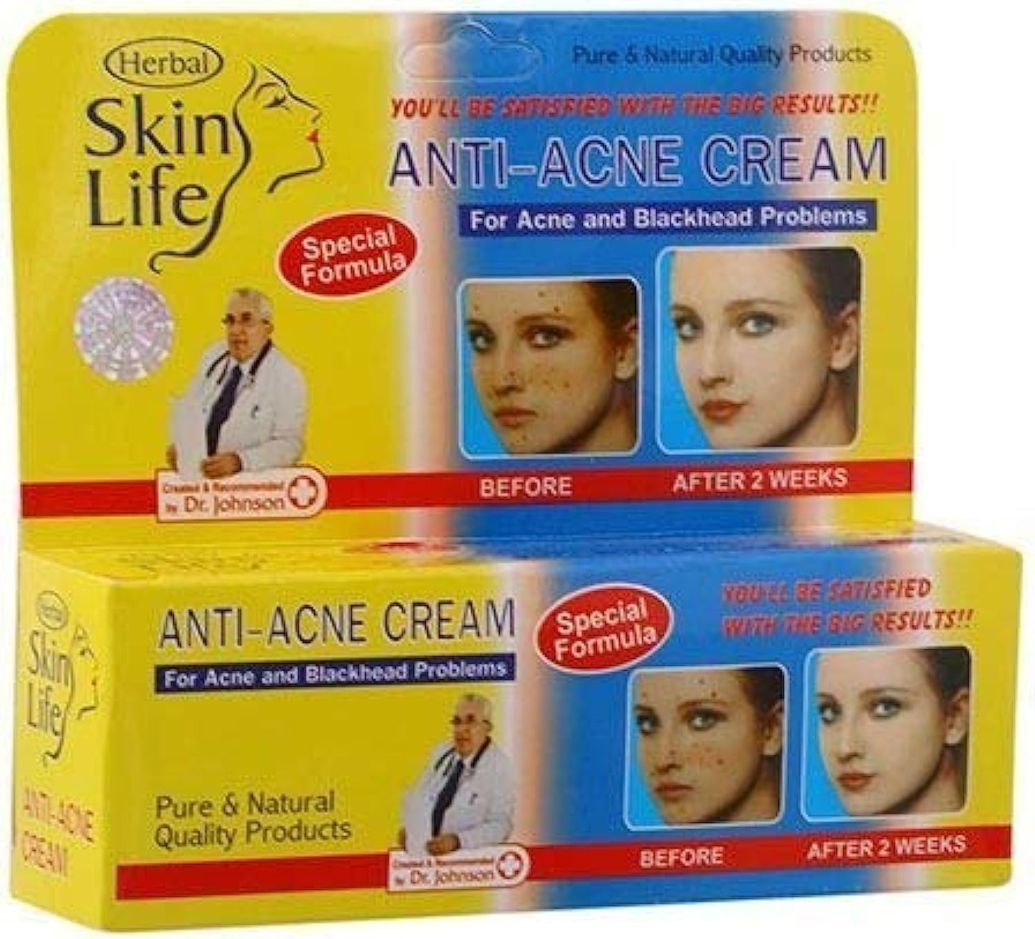 Skin Life Anti-Acne Cream (50ml)