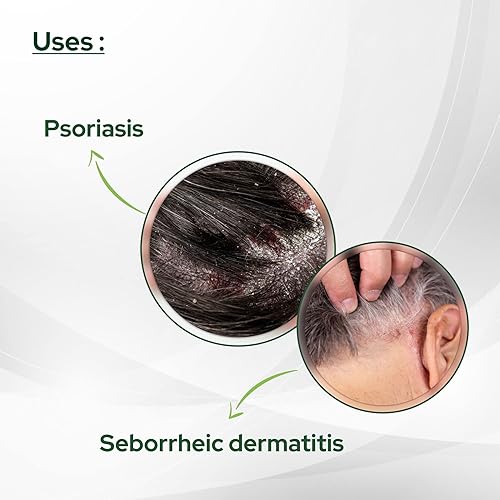 Miniatura 3 de SALVE Cosalic - Barra de baño de alquitrán de carbón con aceites esenciales (2.64 onzas), paquete de 2, barra de limpieza suave para uso diario,