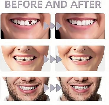 Silicone Reline Denture Set for Women,Full Set Dentures,Silicone Soft Dentures Reline Kit Repair for Men and Women,Dentures False Teeth Set,Snap On Veneers Teeth,Silicone Denture Set