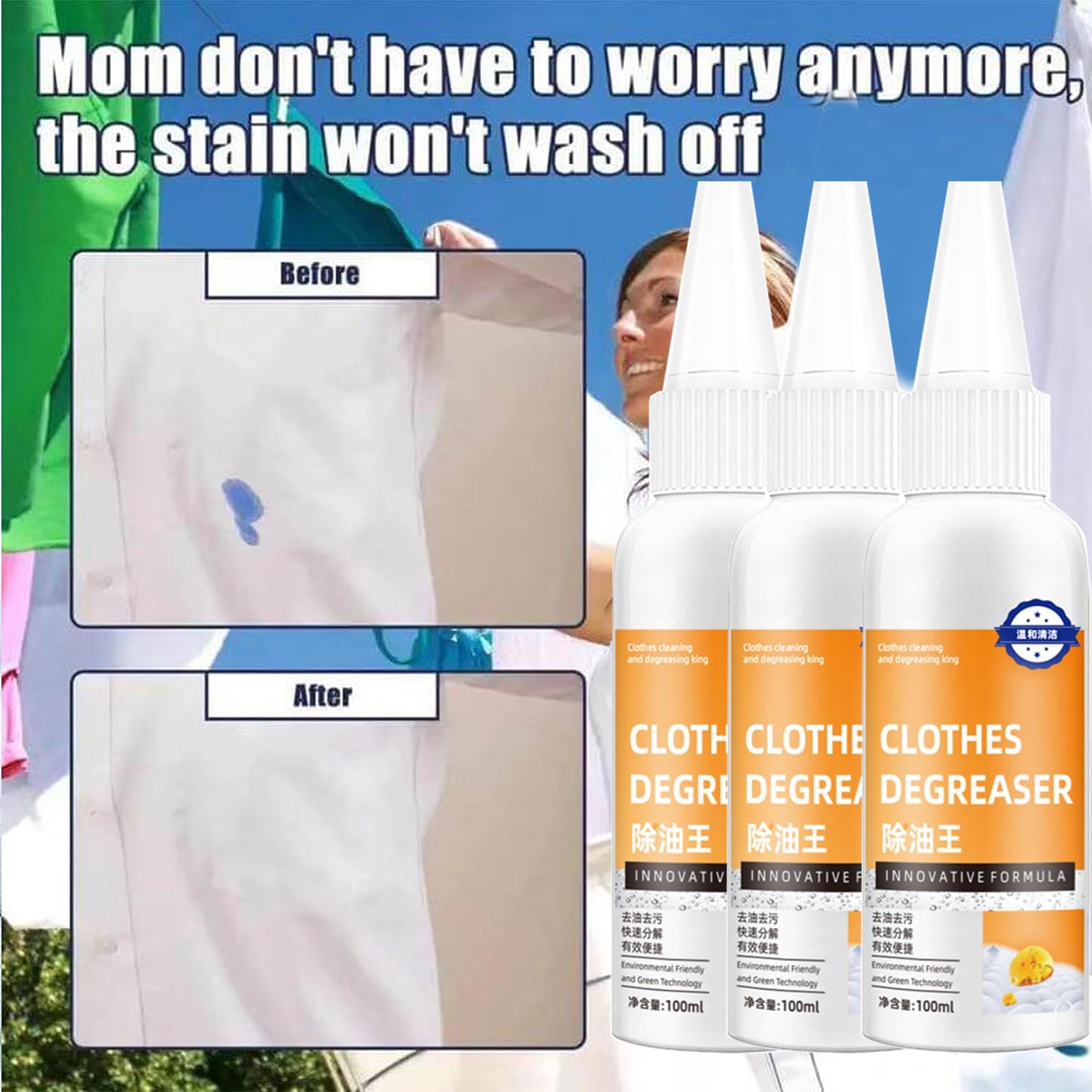 Active Enzymes for Clothes Cleaning, Active Enzyme Laundry Stain Remover for Clothes, Garment