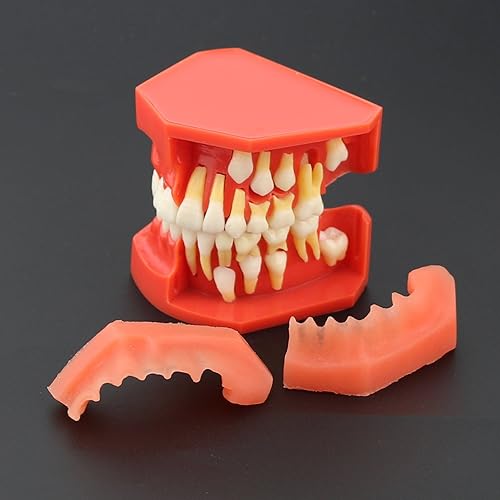 Miniatura 4 de Modelo de dientes dentales Typodont Desarrollo pediátrico 9-12 años Dientes Constantes crecen Reemplazar Demostración Anatomía Enseñanza Estudio