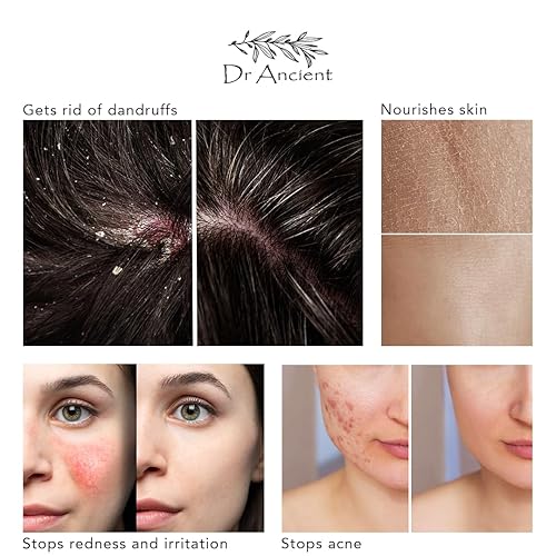 Vista 48 de Barra de jabón de leche de burro orgánica, natural, tradicional, hecha a mano, antienvejecimiento, humectante, absolutamente sin productos químicos