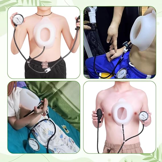 Pectus Excavatum Vacuum Bell - Pectus Excavatum Orthosis Brace for Adults and Child, Corrects Sunken Chest, Vacuum Bell Therapy, Comfortable Fit Upgrade-S