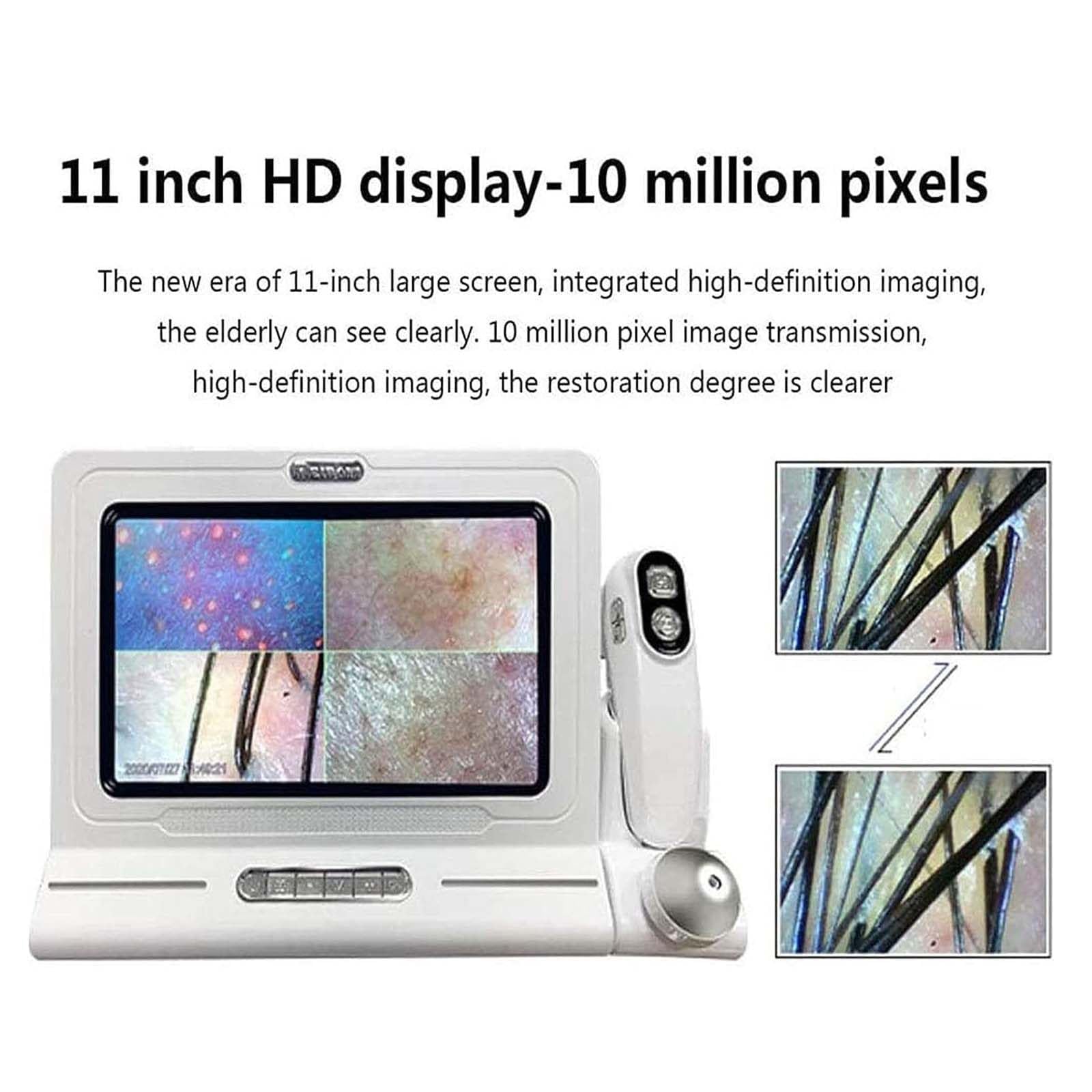 Analizador de diagnóstico de piel, 11 pulgadas, 50 x 200 x, tipo de carga digital, microscopio de cuero cabelludo, folículo piloso, detector de pelo de piel, máquina para el hogar, salón de belleza