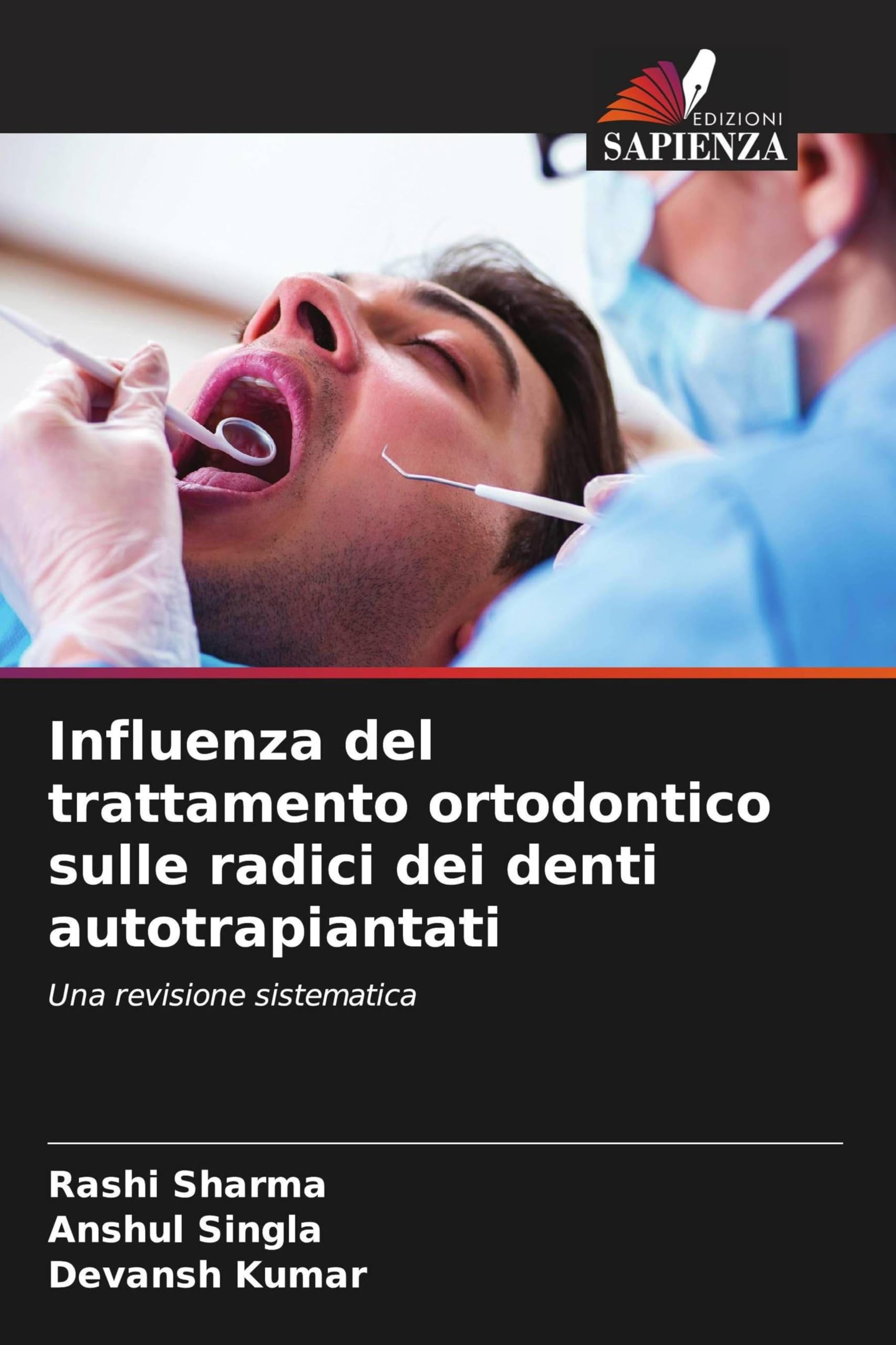 Influenza del trattamento ortodontico sulle radici dei denti autotrapiantati: Una revisione sistematica