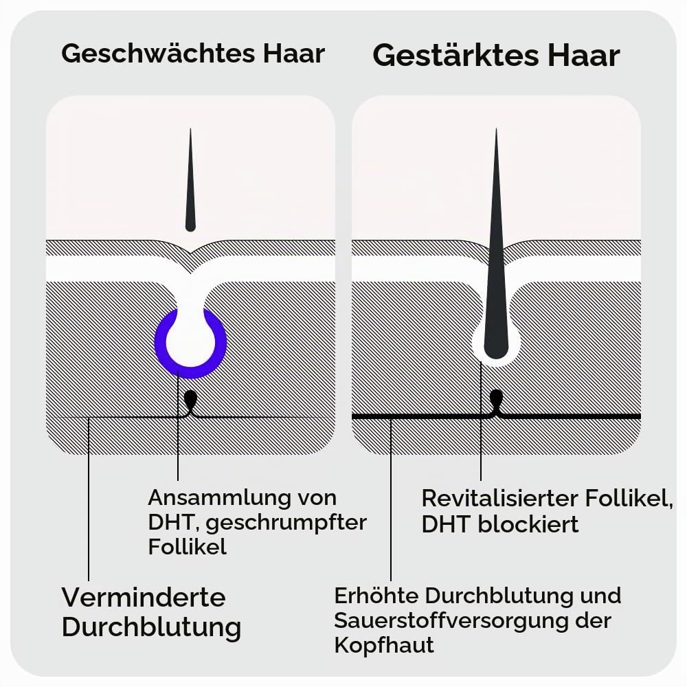 Sons Minoxidil 5%, Haarwachstum Shampoo & Biotin für Männer bei Haarausfall | Klinisch Bewährt, Ergebnisse nach 3 Monaten, Shampoo mit Koffein & Sägepalme, Zitrusduft, 3-Monats-Vorrat.