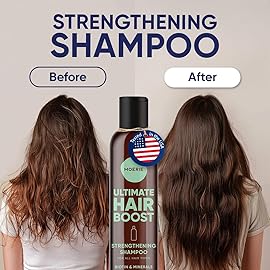 Moerie Ultimate Hair Growth Shampoo - For Longer, Thicker, Fuller Hair - Vegan Friendly Volumizing Hair Products - Paraben & Silicone Free - All Hair Types - Reverse Hair Loss - 8.45 fl oz, Double Set