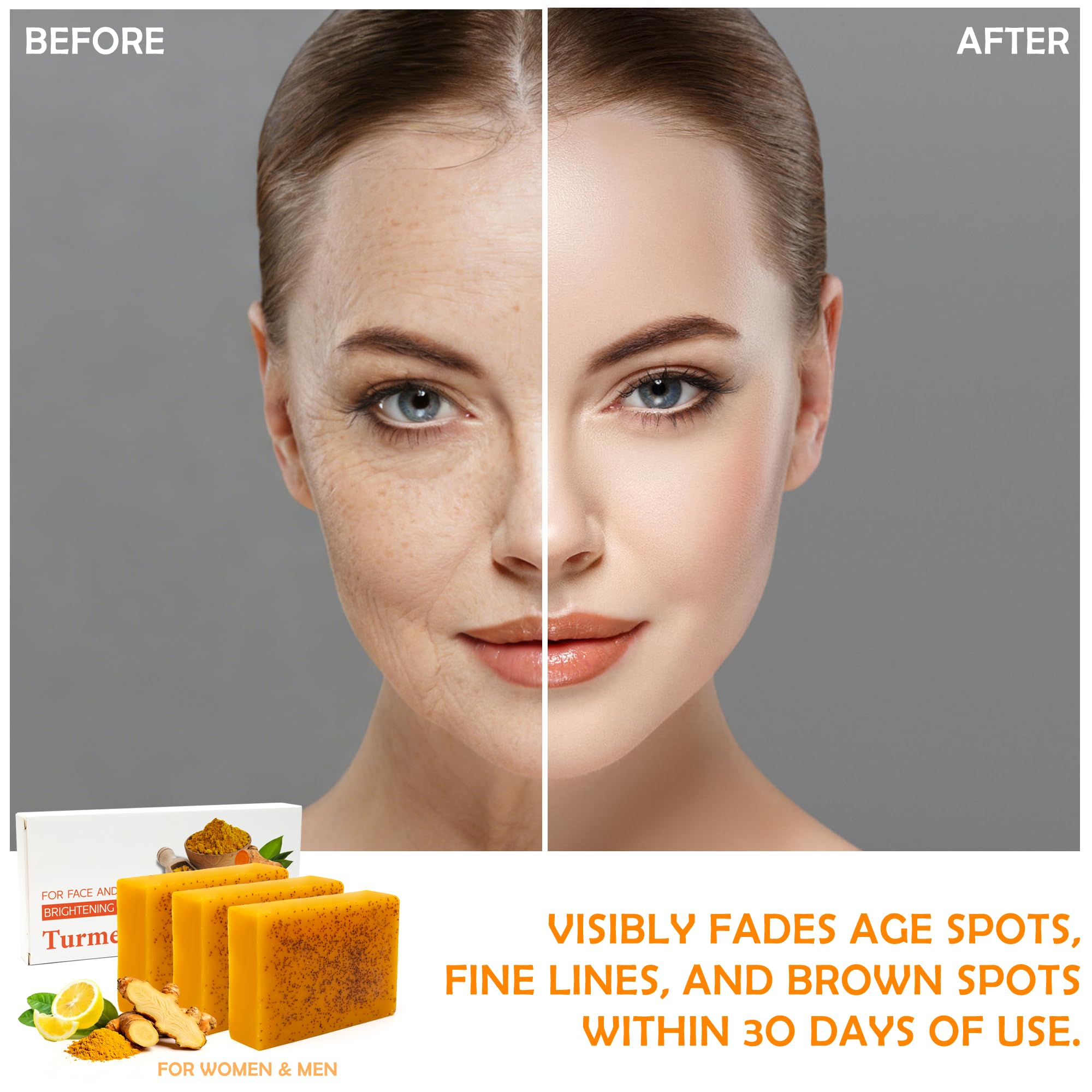 Lot de 3 Savon Curcuma Visage et Corps avec 3 Filets Moussants - Kojic Acid Soap - Savon à l'Acide Kojique Éclaircissant Anti-Taches Brunes, Acné, Hyperpigmentation - Teint Uniforme et Éclatant