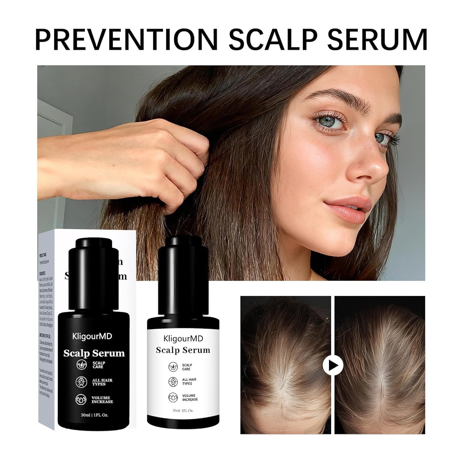 Official Hair Serum Bundle – Thinning Hair Treatment with Plant-Based Actives, Prevention & Treatment Scalp Serum Bundle for Men & Women, Reduces Hair Fall | Women & Men