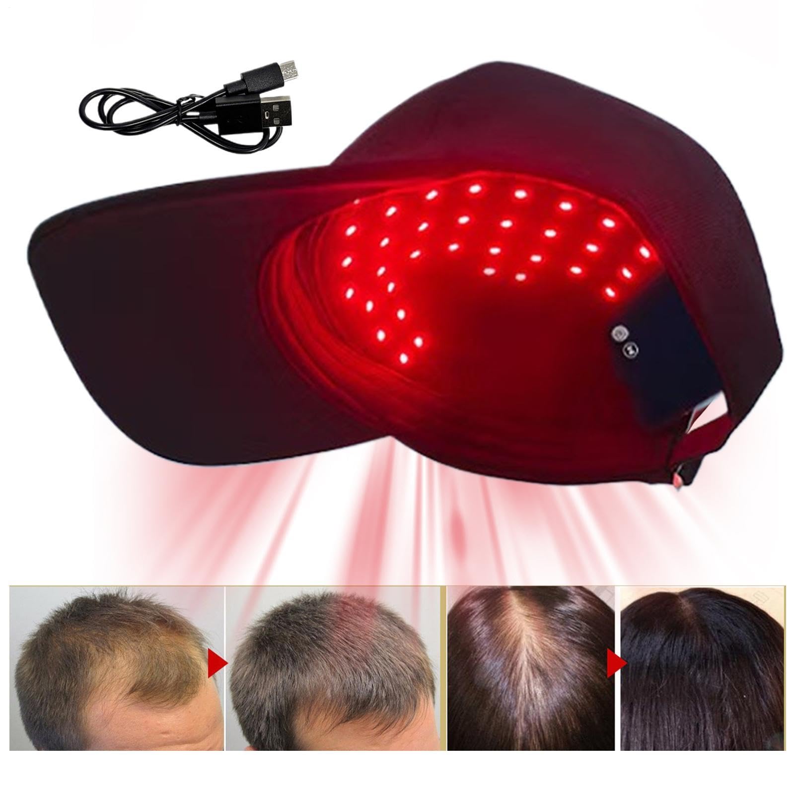 Casque De Thérapie À Lumière Rouge, Dispositif De Soin Capillaire Led 650Nm, Design Rechargeable, Casque Portable D’épaississement Capillaire Pour La Santé Du Cuir Chevelu Et Le Traitement