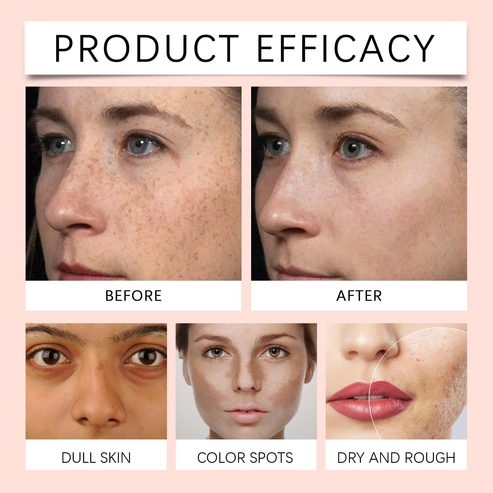 glutathion haut aufhellen Glutathione White Serum, Serum mit Vitamin C und Kojisäure, Aufhellende Serum, Feuchtigkeitsspendendes Serum, Verbesserung des Hauttons, Gesichtsserum für alle Hauttypen, 30ml (1) Kosmetik VITAMIN B12 WIEDEMANN 1