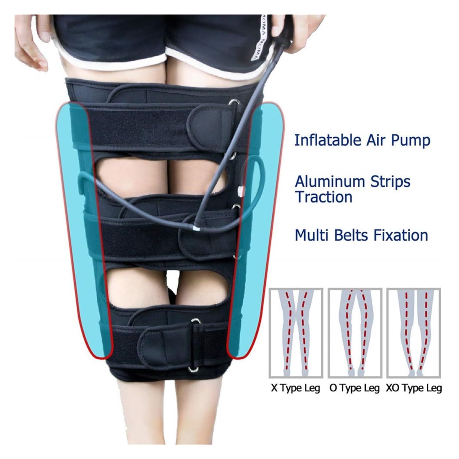Corrector de piernas arqueadas y rodillas valgas｜Faja correctora piernas X/O regulable para niños y adultos con soporte aluminio extraíble y compresión doble bolsa de aire