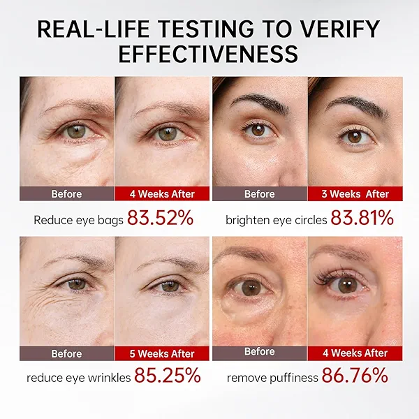 Retinol & Caffeine Eye Serum -360° Massage Roller for Puffiness,Eyebag Remover,Wrinkle Filler,Under Eye Cream For Dark Circles 0.54fl.oz (Pack of 1)