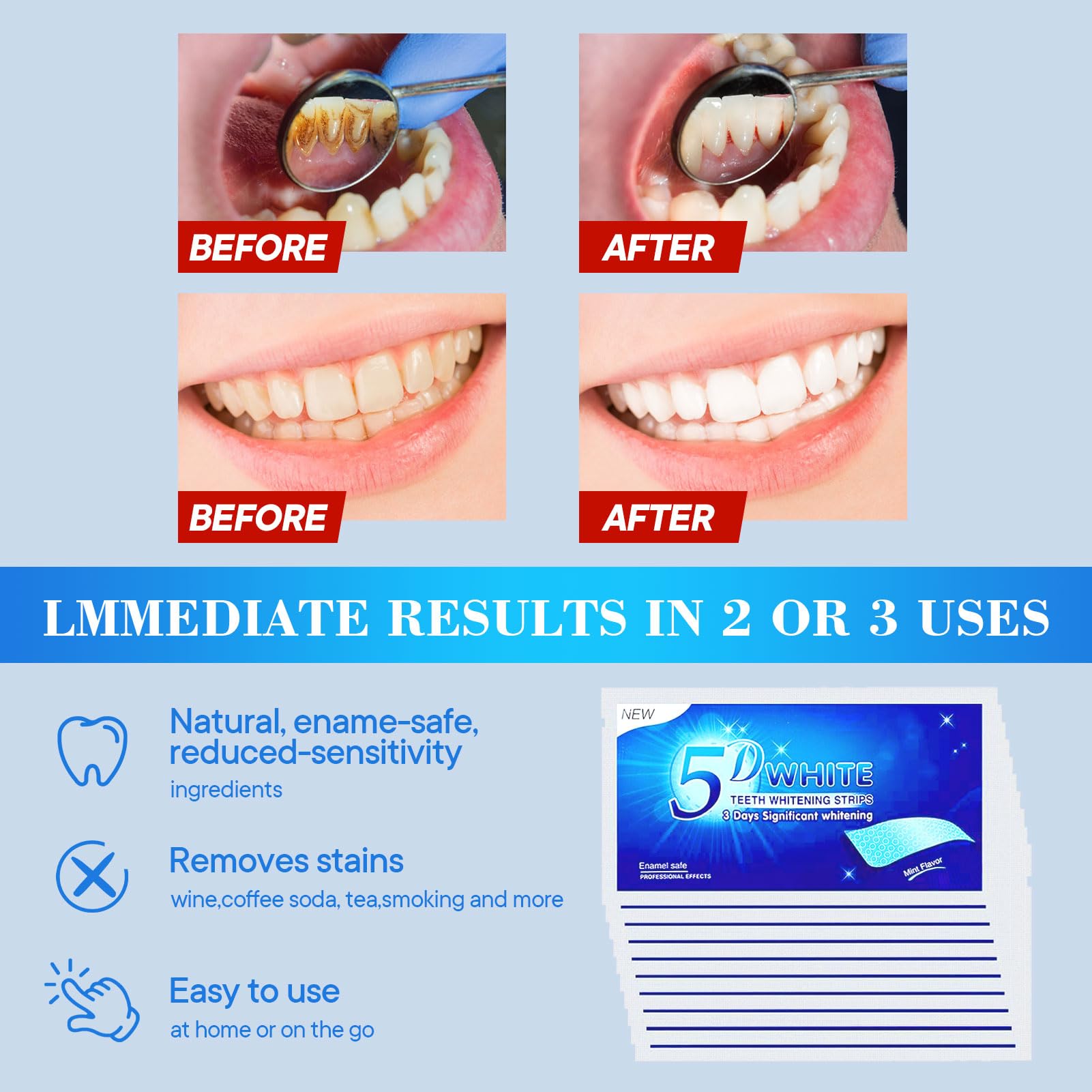 chimoo Sbiancante Denti,28 Striscie Strisce Sbiancanti Denti Sbiancante Denti Professionale kit Sbiancamento Denti Whitening Strips Rimuove le Macchie Profonde Teeth Rapid Whitening Sicuro per Smalto
