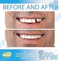 Vista 2 de Instant Smile Perlas de ajuste temporal de reemplazo de dientes temáticos