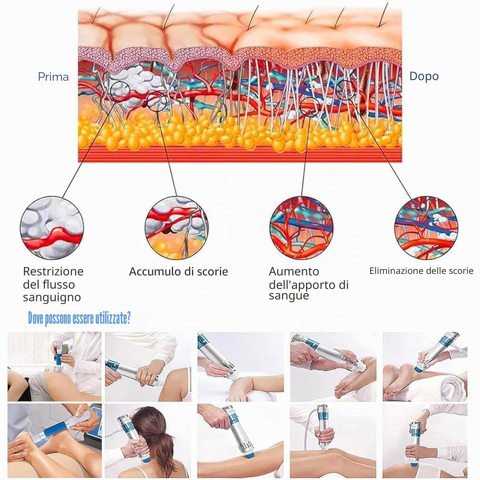 Dispositivo di terapia ad onde d'urto focalizzate, macchina professionale per terapia ED Shockwave con 7 teste di massaggio, 12 fisioterapia regolabile e profonda a energia/Dì addio alla sub-salute