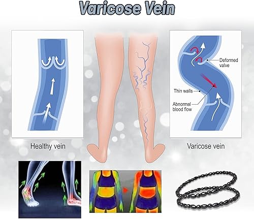 Miniatura 4 de Hion Paquete de 4 tobilleras de obsidiana negra antihinchazón de terapia magnética para mujeres y hombres, pulseras de tobillo de obsidiana negra,