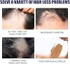 Hair Regrowth Foam for Men,Treatment for Men Growth Serum,Hair Regrowth Spray Foam Growth,60g
