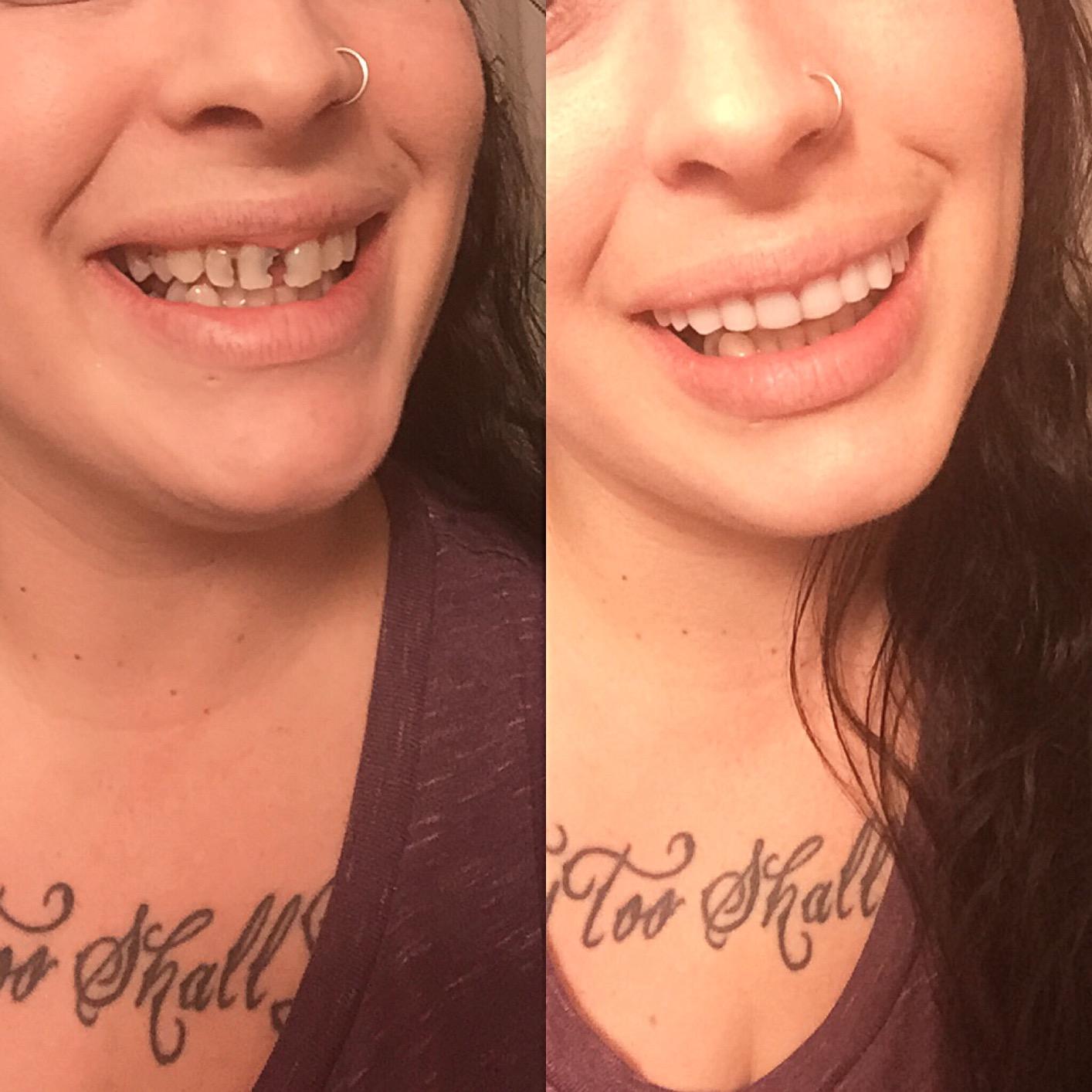 Customer review image