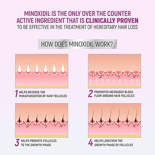 Miniatura 4 de Taro Minoxidil para mujeres, 2.11 onzas (suministro de 2 meses) clínicamente probado para volver a crecer el cabello, espuma de aerosol tópico 5%,