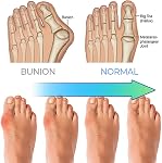 Orthopedic Walking Shoes for Men, Men's Slip-on Mules Half Sneakers, Orthopedic Plantar Fasciitis Relief Slippers, Sports Shoes Loafers Slippers Low Top, Open Back Sneaker Casual Walking Shoes Outdoor