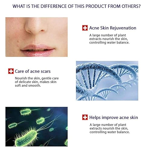 Miniatura 3 de BIOAQUA Juego de cuidado facial 4 en 1, crema para eliminar cicatrices y manchas, limpiador de espuma de 3.53 onzas, máscara facial, 4 piezas,