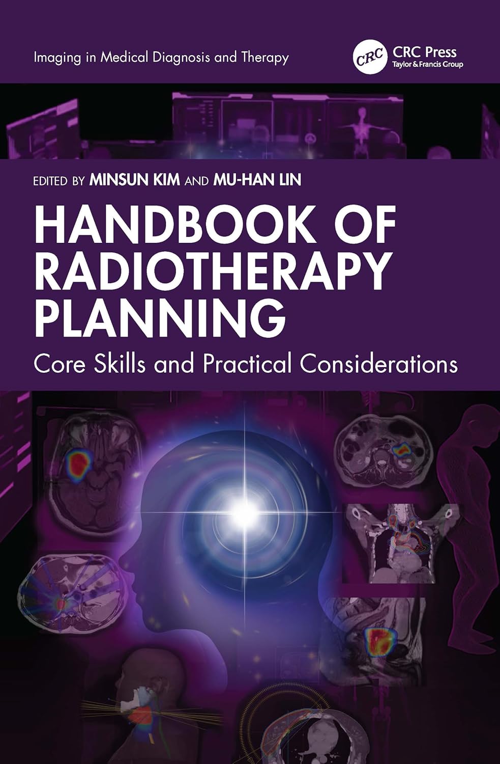 Handbook of Radiotherapy Planning: Core Skills and Practical Considerations (Imaging in Medical Diagnosis and Therapy)      1st Edition, Kindle Edition