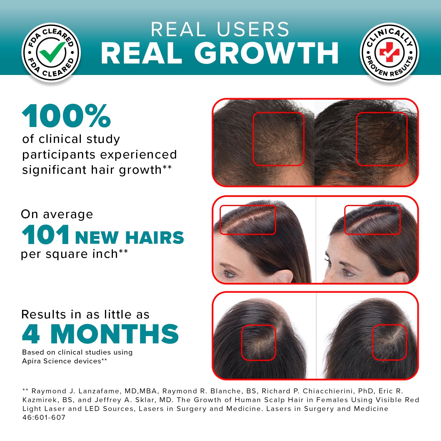 iGrow Laser Hair Growth System - Red Light Therapy, Clinically Proven, FDA Cleared Laser Cap Hair Growth for Men & Women - Image 6