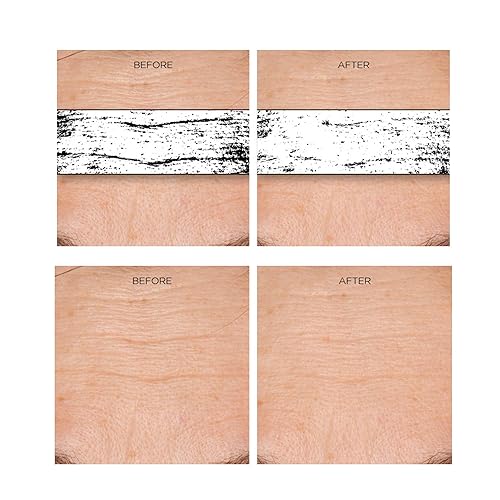 Miniatura 6 de Concentrado Rejuvenecedor y Eliminador de Arrugas Extreme de Erasa XEP30