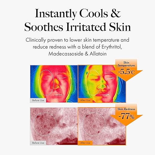 Miniatura 10 de White Mastic Body Mist (5.1 onzas líquidas) - Aligera las cicatrices del acné, calma y enfría. Spray corporal para una piel impecable. Goma de