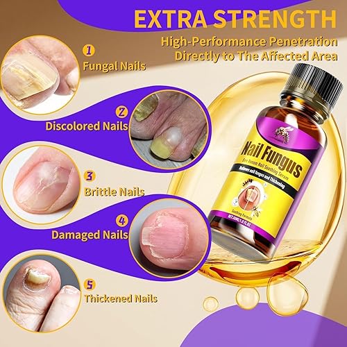 Miniatura 5 de Tratamiento de hongos en las uñas de los pies extra fuerte, tratamiento de hongos en las uñas del pie, tratamiento de hongos de hongos en las uñas,