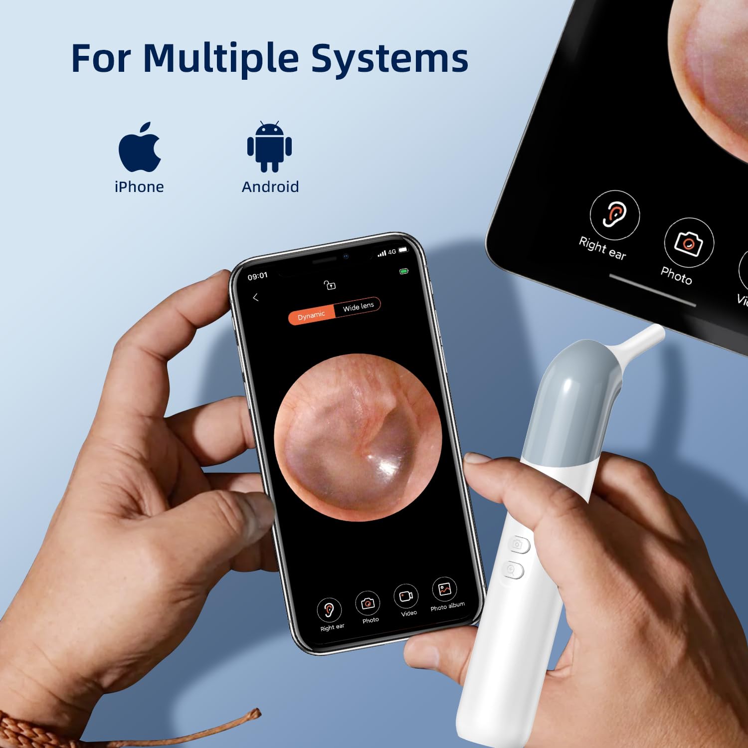 Otoscope sans fil WiFi 1080p avec 6 lumières LED, 10 accessoires pour enfants, animaux et adultes, compatible Android et iPhone