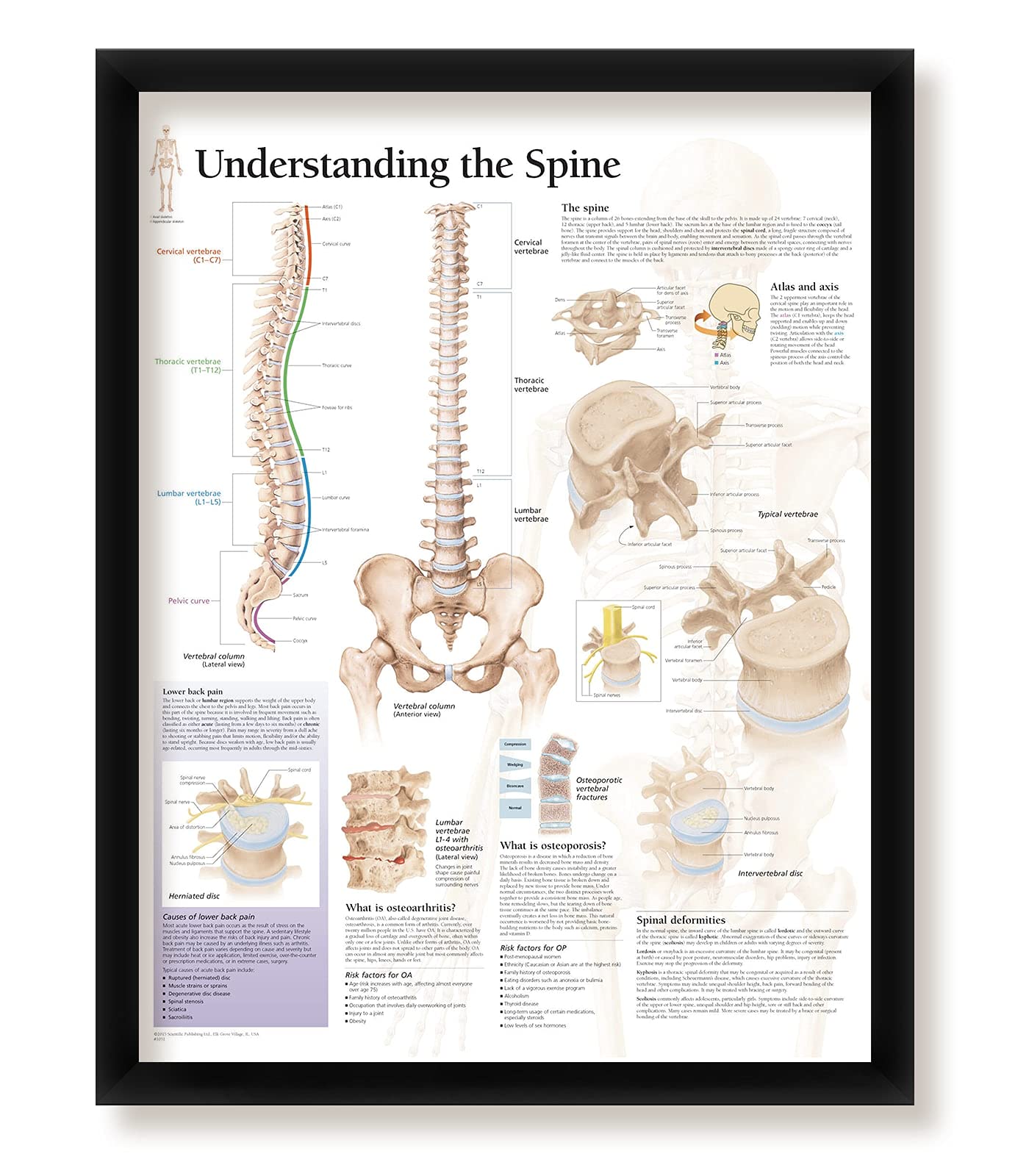 Anatomy and Injuries of The Shoulder Anatomical Chart Poster 20 x 26in