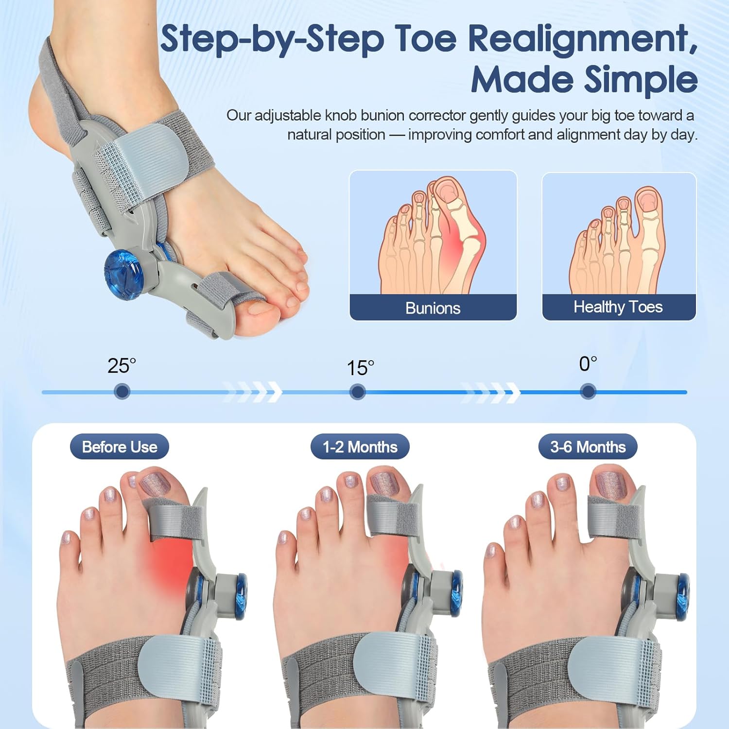 Bunion Corrector for Women Men Big Toe,Adjustable Knob Bunion Corrector for Bunion Relief,Bunion Fix with Bunion Silicone Pad,Suitable for Left and Right Feet(1PCS) - Image 2