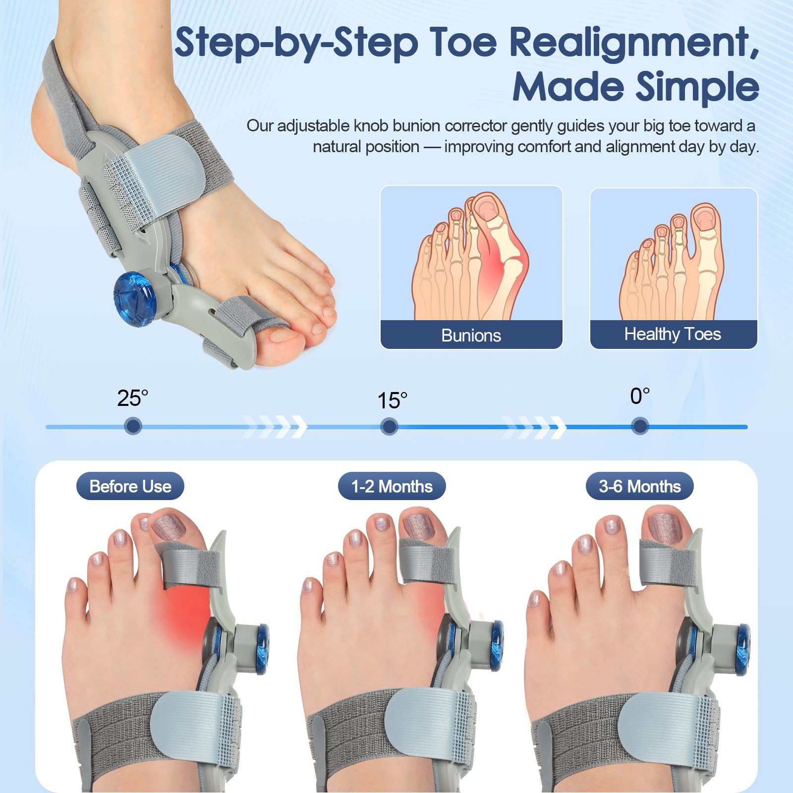 Condition photo showing New/Like New for bunion corrector for women men big toe,adjustable knob bunion corrector for bunion relief,bunion fix with bunion silicone pad,suitable for left and right feet(1pcs)