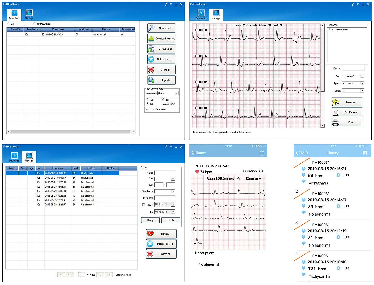 newgen medicals EKG für Zuhause: Mobiles medizinisches EKG-Messgerät mit PC-Software und App (Gerät, Gerät für Zuhause, Mobile)