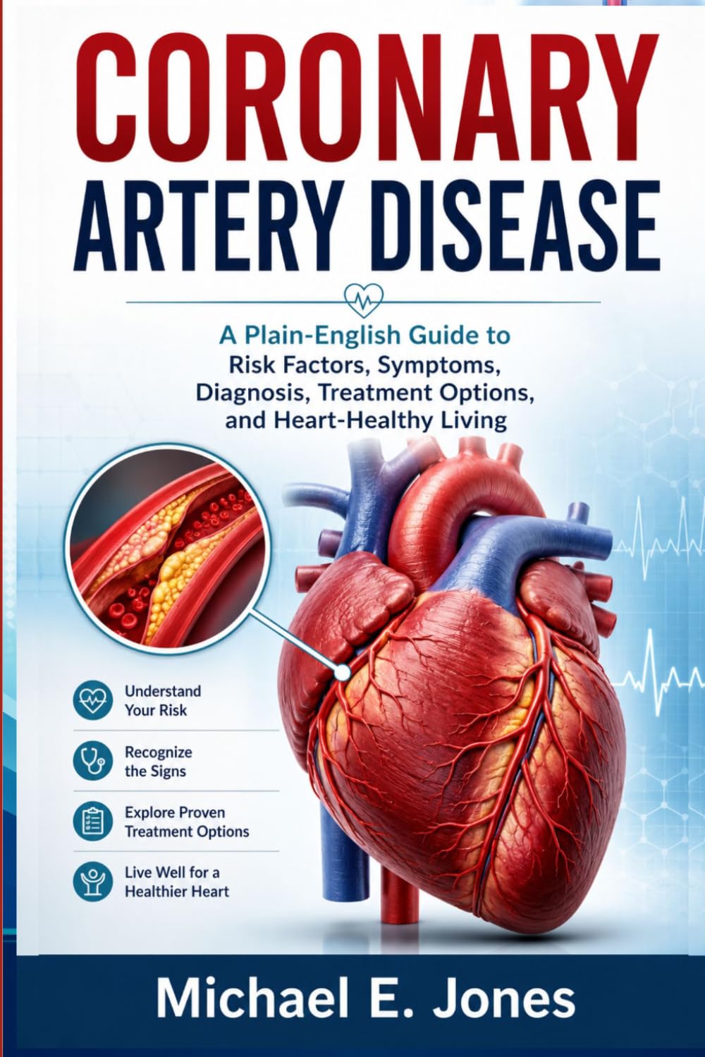 Coronary Artery Disease: A Plain-English Guide to Risk Factors, Symptoms, Diagnosis, Treatment Options, and Heart-Healthy Living