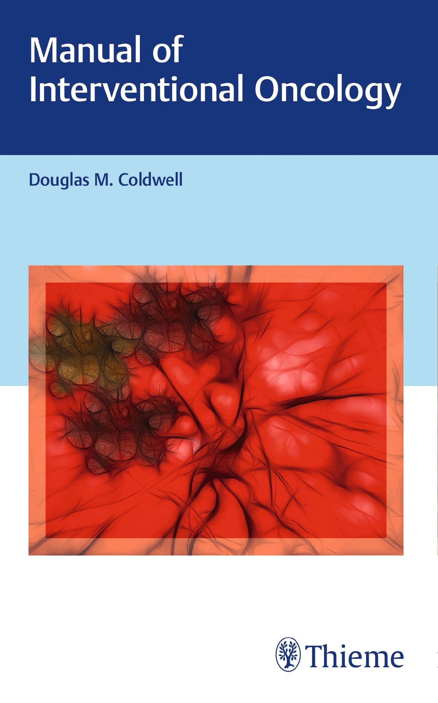 Buy Manual of Interventional Oncology — BookShops.in