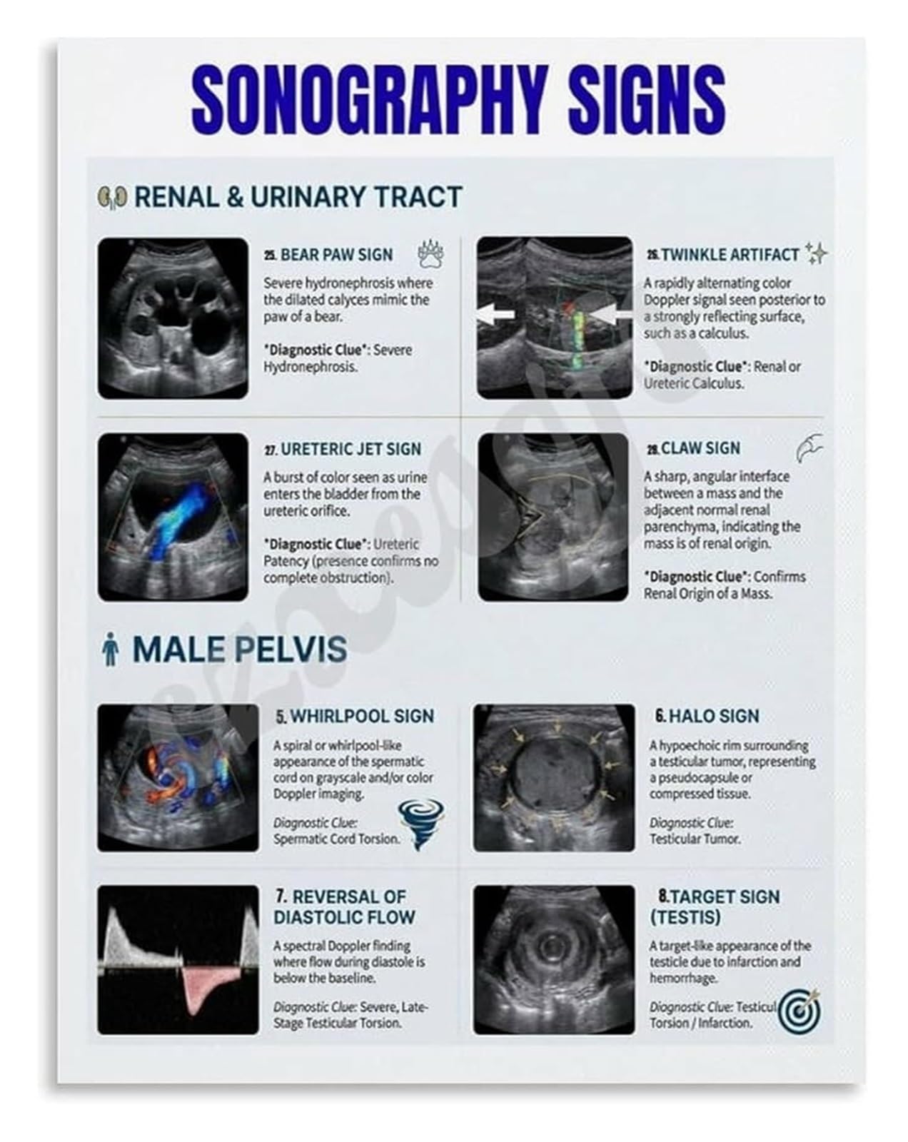 FOPURE Diagnostic Sonography Poster Key Signs and Pathology Chart Canvas Wall-Art for Radiology Department(Framed,08x12inch(20x30cm))